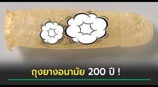 ถุงยางอนามัย