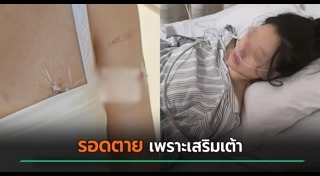 เสริมหน้าอก