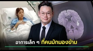 โรคหลอดเลือดสมอง