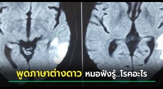 ป่วยแปลก