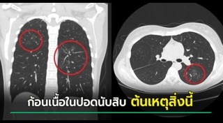 ตรวจสุขภาพ