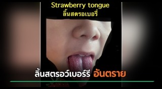 โรคเด็ก