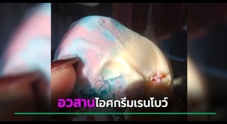 อาหารสกปรก