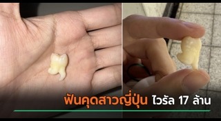 ข่าวต่างประเทศ