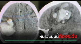 โรคของแมว