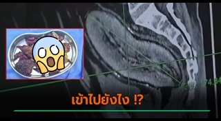 ข่าวจีน