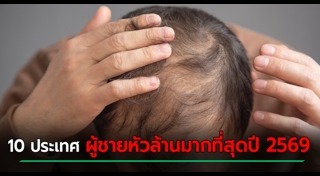 หัวล้าน
