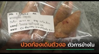 ปวดท้อง