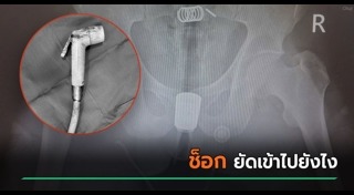 ข่าวต่างประเทศ