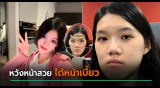 ศัลยกรรมหน้าพัง