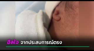 เด็กพิการ