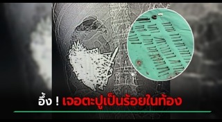 ป่วยแปลก