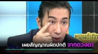 หนุ่ม กรรชัย