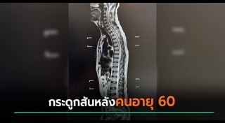 กระดูก