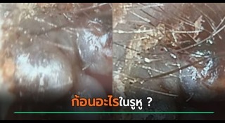 ข่าวจีน